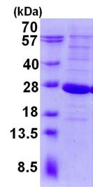 SDS-PAGE - Recombinant Human LYG2 protein (AB134601)