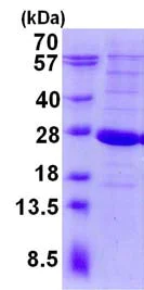 SDS-PAGE - Recombinant Human LYG2 protein (His tag N-Terminus) (AB134601)