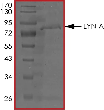 SDS-PAGE - Recombinant human Lyn protein (AB70789)