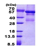 SDS-PAGE - Recombinant Human Lyn protein (denatured) (His tag N-Terminus) (AB139777)