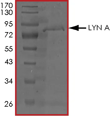 SDS-PAGE - Recombinant human Lyn protein (GST tag N-Terminus) (AB70789)