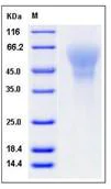 SDS-PAGE - Recombinant Human LYPD3 protein (His tag) (AB276436)