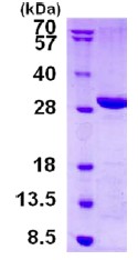 SDS-PAGE - Recombinant Human LYPLAL1 protein (His tag N-Terminus) (AB130056)