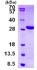 SDS-PAGE - Recombinant Human LYPLAL1 protein (His tag N-Terminus) (AB130056)
