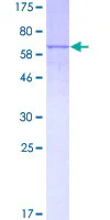 SDS-PAGE - Recombinant Human Lysosomal acid lipase/LAL protein (GST tag N-Terminus) (AB152501)
