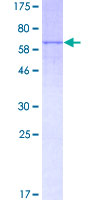 Recombinant Human Lysosomal acid lipase/LAL protein (Tagged)