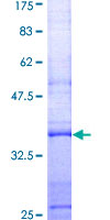 Recombinant Human Lysozyme protein