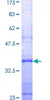 SDS-PAGE - Recombinant Human Lysozyme protein (GST tag N-Terminus) (AB158839)