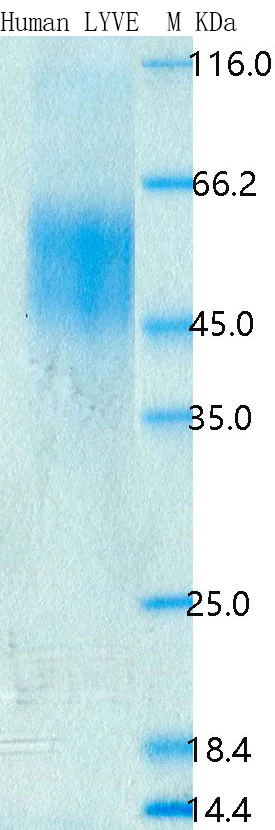 SDS-PAGE - Recombinant Human LYVE1 Protein Standard (His tag) (AB316495)