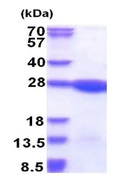 SDS-PAGE - Recombinant Human LZIC protein (AB177652)
