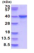 SDS-PAGE - Recombinant Human LZTFL1 protein (His tag) (AB202217)