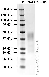 SDS-PAGE - Recombinant human M-CSF protein (Active) (AB259396)
