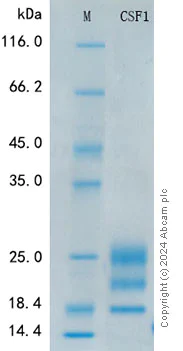SDS-PAGE - Recombinant Human M-CSF Protein Standard (His tag) (AB316423)