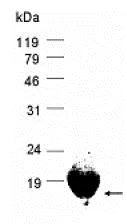 SDS-PAGE - Recombinant Human M6PR (cation dependent) protein (AB80157)