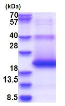 SDS-PAGE - Recombinant Human M6PR (cation dependent) protein - BSA and Azide free (His tag N-Terminus) (AB180308)