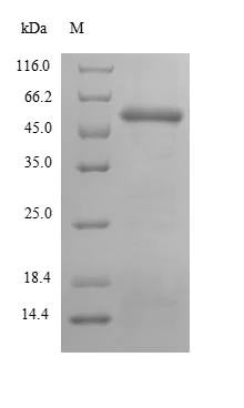 SDS-PAGE - Recombinant Human MA2 protein (Tagged) (AB235855)