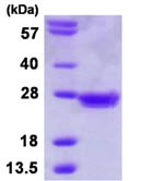 SDS-PAGE - Recombinant Human Mad2L1 protein (His tag N-Terminus) (AB113604)