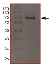 SDS-PAGE - Recombinant Human MADM protein (AB204143), expandable thumbnail
