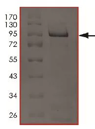 SDS-PAGE - Recombinant Human MADM protein (AB204143)