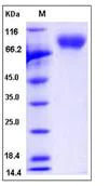 SDS-PAGE - Recombinant Human MAG/GMA protein (His tag) (AB276508)