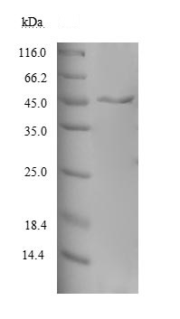 SDS-PAGE - Recombinant Human MAGEA10 protein (His tag) (AB235805)