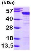 SDS-PAGE - Recombinant Human MAGEA4 protein (AB99138)