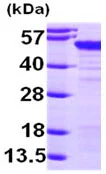 SDS-PAGE - Recombinant Human MAGEA4 protein (AB99138)