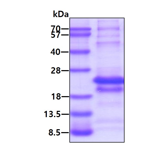 SDS-PAGE - Recombinant Human MAGEA5 protein (His tag N-Terminus) (AB124572)