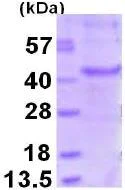 SDS-PAGE - Recombinant Human MAGEA6 protein (His tag C-Terminus) (AB126656)