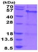 SDS-PAGE - Recombinant Human MAGEA8 protein (AB202614)