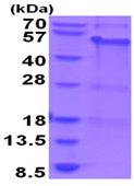 SDS-PAGE - Recombinant Human MAGEA8 protein (His tag N-Terminus) (AB202614)