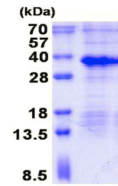 SDS-PAGE - Recombinant Human MAGP1 protein (denatured) (AB136704), expandable thumbnail