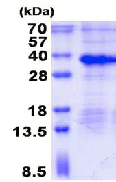 SDS-PAGE - Recombinant Human MAGP1 protein (denatured) (His tag N-Terminus) (AB136704)