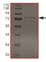 SDS-PAGE - Recombinant human MAK protein (AB190407)