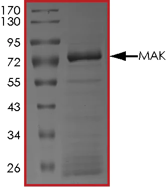 SDS-PAGE - Recombinant human MAK protein (AB190407)