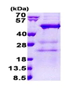 SDS-PAGE - Recombinant Human MAK3 protein (His tag N-Terminus) (AB167910)