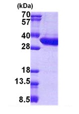 SDS-PAGE - Recombinant Human Malectin protein (AB167903)
