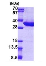 SDS-PAGE - Recombinant Human Malectin protein (His tag N-Terminus) (AB167903)