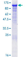 Recombinant Human MALT1/MLT protein