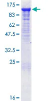 SDS-PAGE - Recombinant Human MALT1/MLT protein (GST tag N-Terminus) (AB161189)