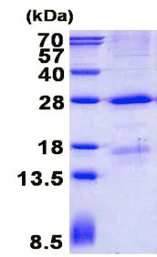 SDS-PAGE - Recombinant Human Mannan Binding Lectin/MBL protein (denatured) (His tag N-Terminus) (AB137143)