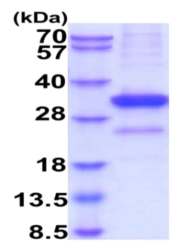 SDS-PAGE - Recombinant Human Mannan Binding Lectin/MBL protein (His tag) (AB229367)