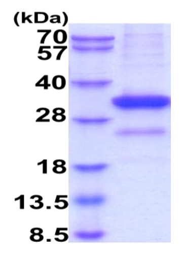SDS-PAGE - Recombinant Human Mannan Binding Lectin/MBL protein (His tag C-Terminus) (AB229367)
