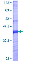 SDS-PAGE - Recombinant Human Mannose Receptor protein (GST tag N-Terminus) (AB152538)