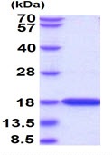SDS-PAGE - Recombinant Human MAP1LC3A protein (His tag C-Terminus) (AB98119)