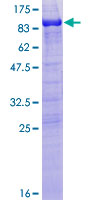 Recombinant Human MAP2 protein