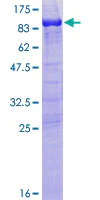 SDS-PAGE - Recombinant Human MAP2 protein (AB114686)