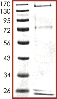 SDS-PAGE - Recombinant human MAP3K1 protein (AB104027)