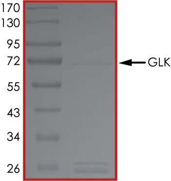 SDS-PAGE - Recombinant human MAP4K3/GLK protein (Tagged) (AB177265)