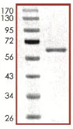 SDS-PAGE - Recombinant human MAP4K4/NIK protein (AB101775)